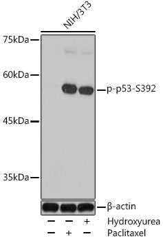 Phospho-p53-S392 Rabbit pAb