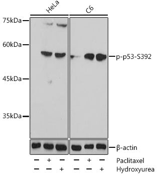 Phospho-p53-S392 Rabbit pAb
