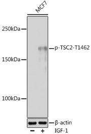 Phospho-TSC2-T1462 Rabbit pAb