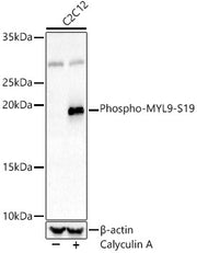 Phospho-MYL9-S19 Rabbit pAb