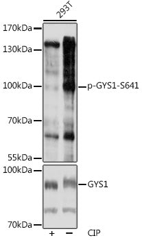 Phospho-GYS1-S641 Rabbit pAb