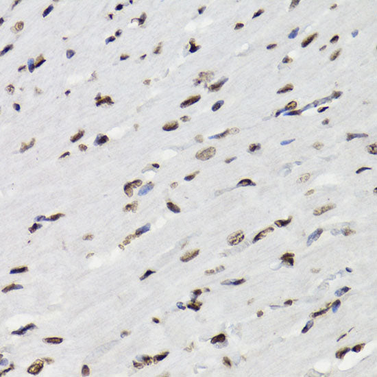 Phospho-STAT5-Y694 Rabbit pAb
