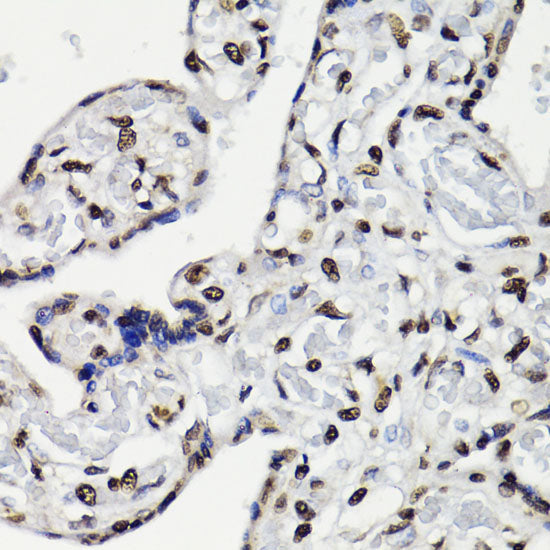Phospho-STAT5-Y694 Rabbit pAb
