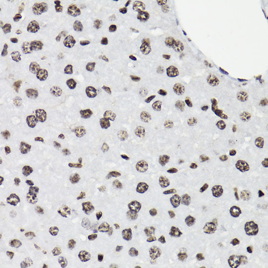 Phospho-STAT5-Y694 Rabbit pAb
