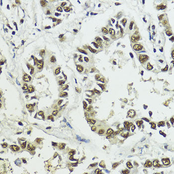 Phospho-Histone H3-S10/T11 Rabbit pAb