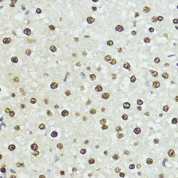 Phospho-Histone H3-S10/T11 Rabbit pAb