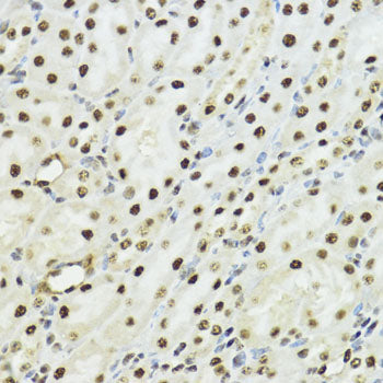 Phospho-Histone H3-S10/T11 Rabbit pAb
