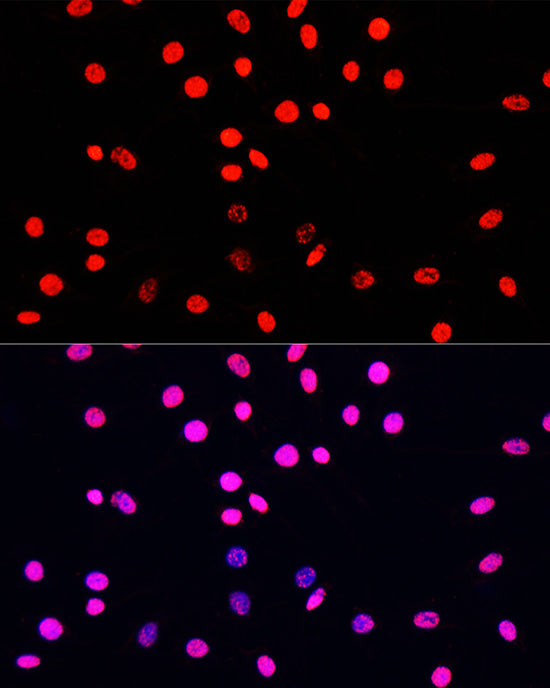 Phospho-Histone H3-S10/T11 Rabbit pAb