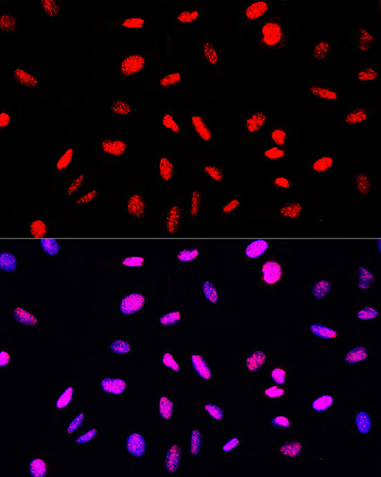 Phospho-Histone H3-S10/T11 Rabbit pAb