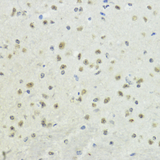 Phospho-Histone H3-T32 Rabbit pAb