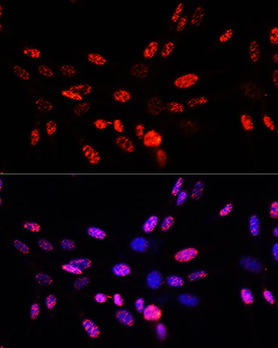 Phospho-Histone H3-T45 Rabbit pAb