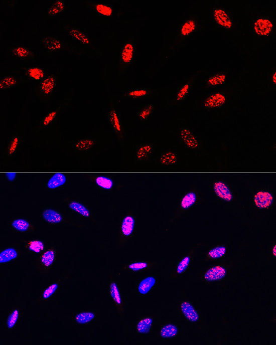Phospho-Histone H3-T45 Rabbit pAb