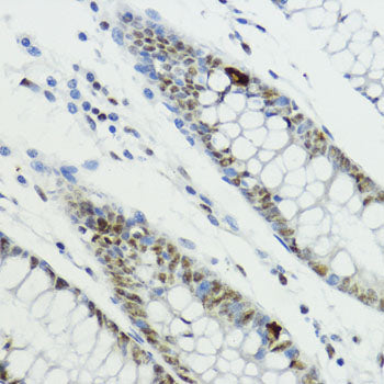 Phospho-Histone H3-T6 Rabbit pAb