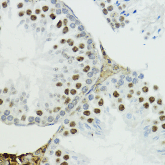 Phospho-Histone H3-T6 Rabbit pAb