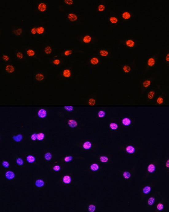 Phospho-Histone H3-T6 Rabbit pAb