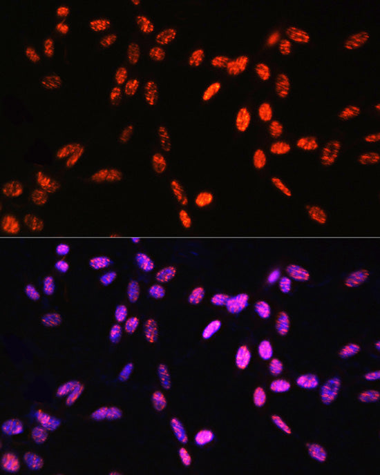 Phospho-Histone H3-T6 Rabbit pAb