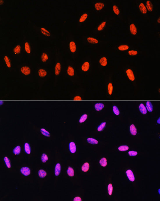 Phospho-Histone H3-T6 Rabbit pAb
