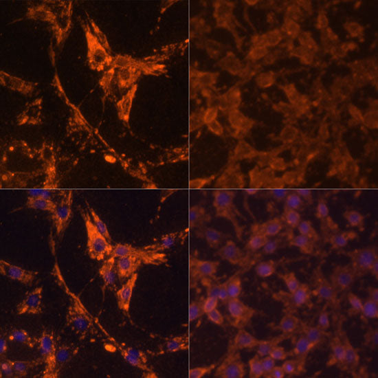 Pan Phospho-Tyrosine Rabbit pAb