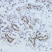 Phospho-Smad2-T220 Rabbit pAb