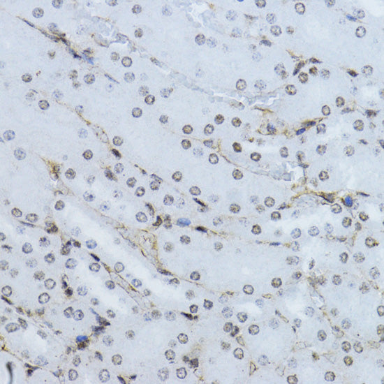 Phospho-Smad2-T220 Rabbit pAb