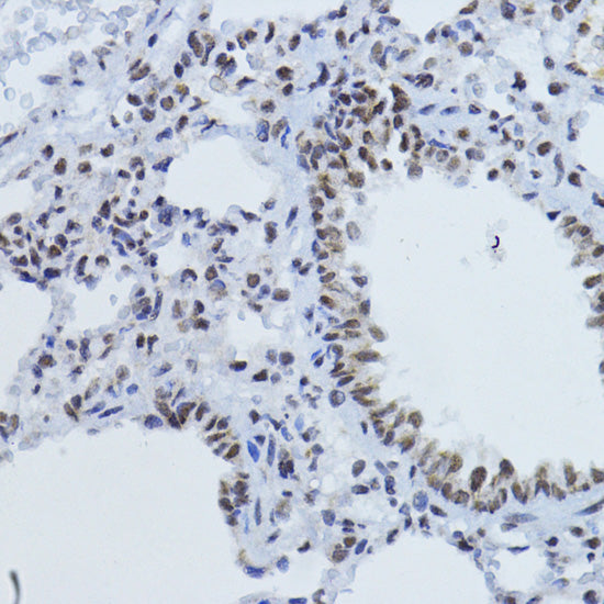 Phospho-Smad2-T220 Rabbit pAb