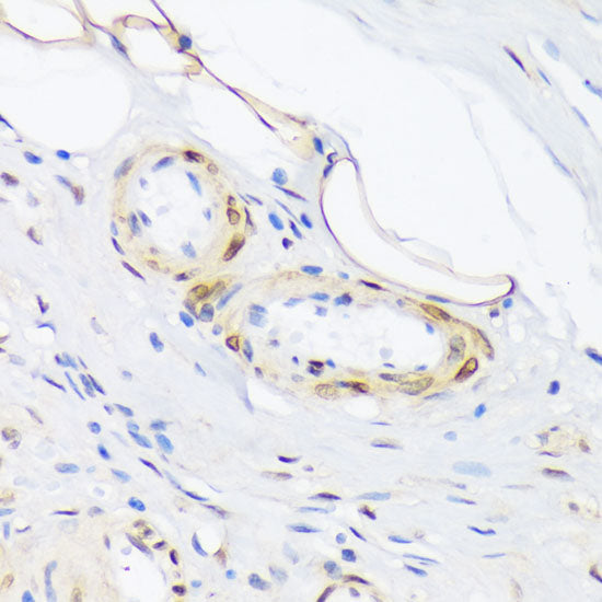 Phospho-PLN-T17 Rabbit pAb