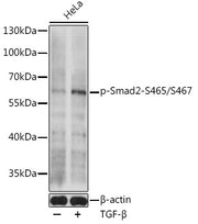 Phospho-Smad2-S465/S467 Rabbit pAb