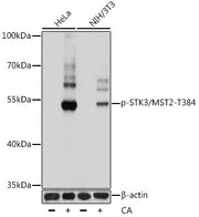 Phospho-STK3/MST2-T384 Rabbit pAb