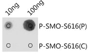 Phospho-SMO-S616 Rabbit pAb