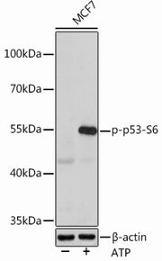 Phospho-p53-S6 Rabbit pAb
