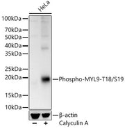 Phospho-MYL9-T18/S19 Rabbit pAb