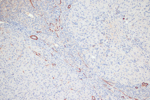 Phospho-MYL9-T18/S19 Rabbit pAb
