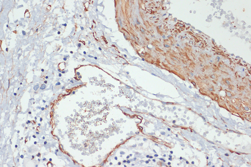 Phospho-MYL9-T18/S19 Rabbit pAb