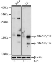 Phospho-PLN-S16/T17 Rabbit pAb
