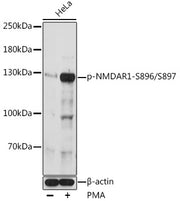 Phospho-NMDAR1-S896/S897 Rabbit pAb