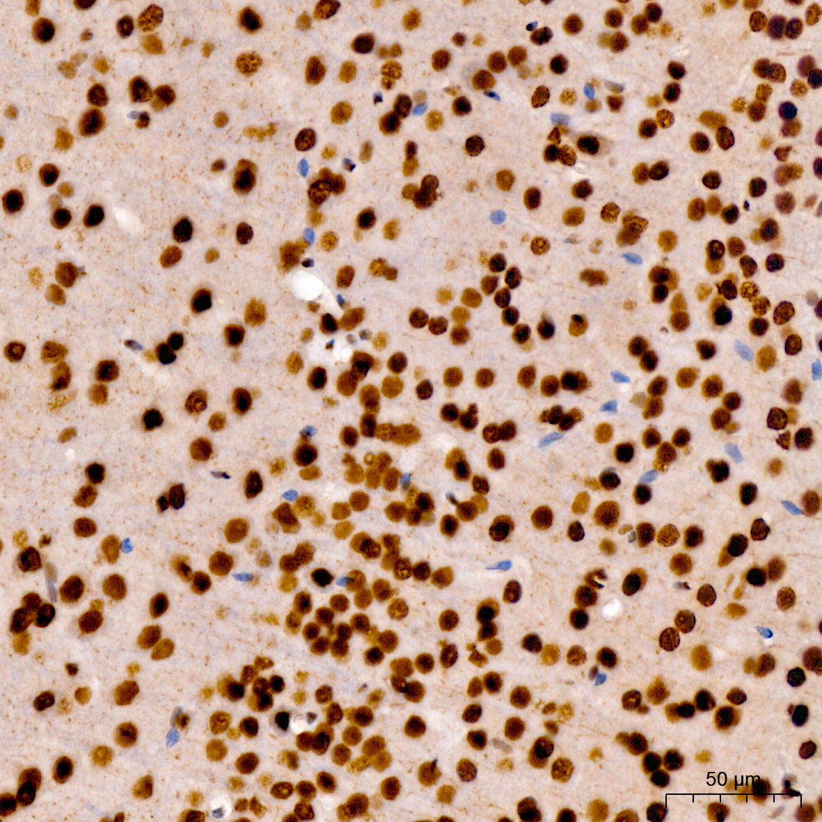 Phospho-POLR2A CTD-S7 Rabbit pAb
