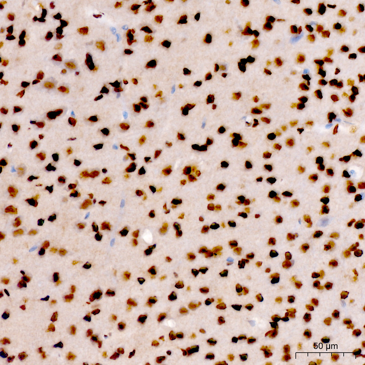 Phospho-POLR2A CTD-S7 Rabbit pAb