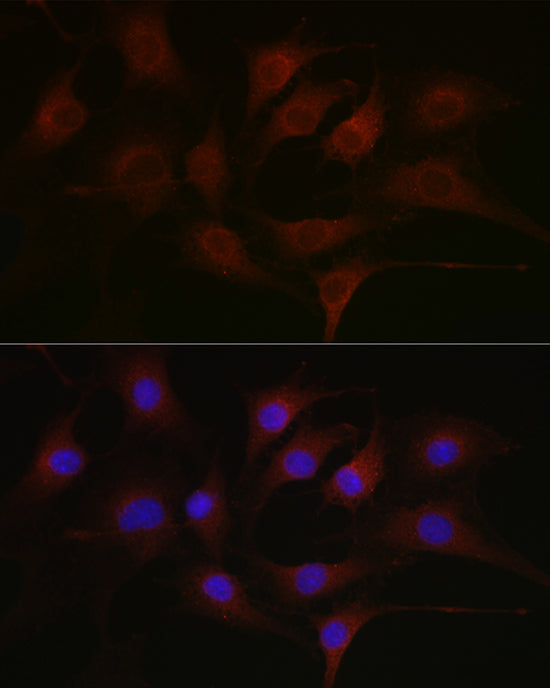 Pan Phospho-Tyrosine Mouse mAb