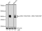 Phospho-ERK1-T202/Y204 + ERK2-T185/Y187 Rabbit mAb