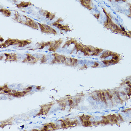 Phospho-ERK1-T202/Y204 + ERK2-T185/Y187 Rabbit mAb