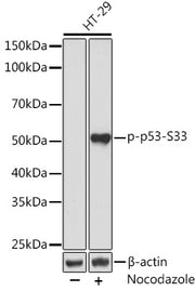 Phospho-p53-S33 Rabbit mAb