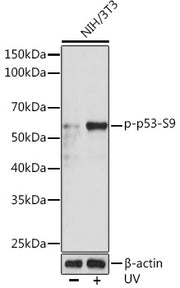 Phospho-p53-S9 Rabbit mAb