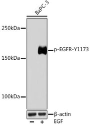 Phospho-EGFR-Y1173 Rabbit mAb
