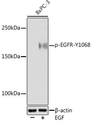 Phospho-EGFR-Y1068 Rabbit mAb