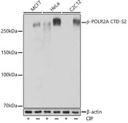 Phospho-POLR2A CTD-S2 Rabbit mAb