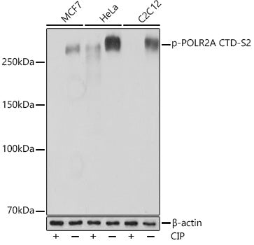 Phospho-POLR2A CTD-S2 Rabbit mAb