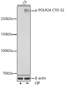Phospho-POLR2A CTD-S2 Rabbit mAb