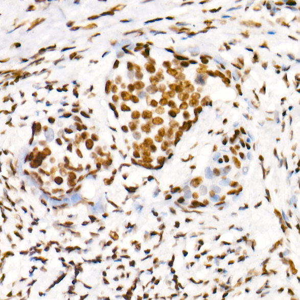 Phospho-POLR2A CTD-S2 Rabbit mAb