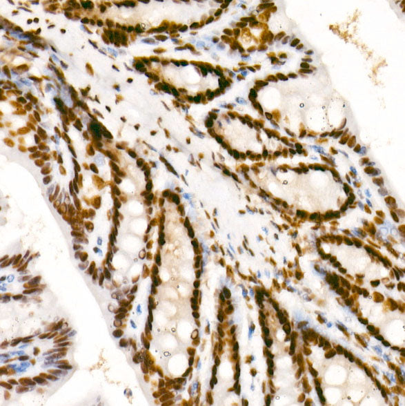 Phospho-POLR2A CTD-S2 Rabbit mAb