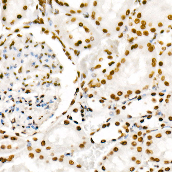 Phospho-POLR2A CTD-S2 Rabbit mAb